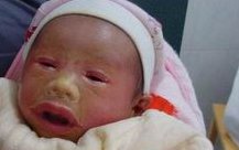 没有卵巢可以做特需试管婴儿吗 卵巢早衰患者能做特需试管助孕吗