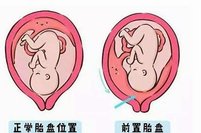 2026年泰国试管婴儿医院的流程是怎么样的？不看不知道！