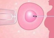 宫寒不孕怎么调理受孕？吃哪些食物好？