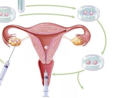 绍兴哪家公立医院做三代试管比较好？需要注意哪些问题？