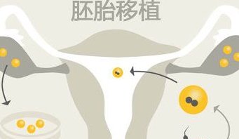 面对没有婚姻证的现实，三代试管婴儿是否还有机会？